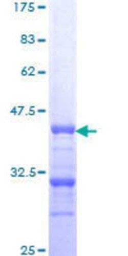 Novus Biologicals Recombinant Human PPP2R2C GST (N-Term) Protein 10 &mu;g | Buy Online | Novus Biologicals&trade; | Fisher Scientific