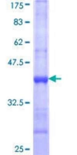 Novus Biologicals Recombinant Human PPP2R4 GST (N-Term) Protein 10 &mu;g | Buy Online | Novus Biologicals&trade; | Fisher Scientific