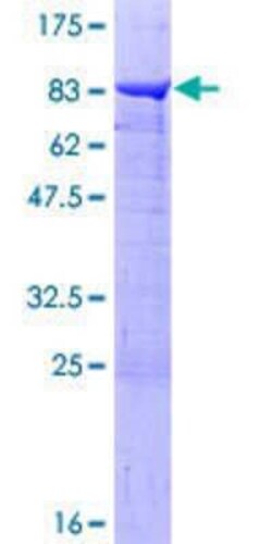 Novus Biologicals Recombinant Human PPP2R5A GST (N-Term) Protein 25 &mu;g | Buy Online | Novus Biologicals&trade; | Fisher Scientific