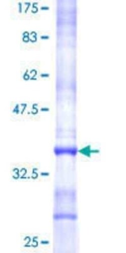 Novus Biologicals Recombinant Human PPP2R5A GST (N-Term) Protein 25 &mu;g | Buy Online | Novus Biologicals&trade; | Fisher Scientific