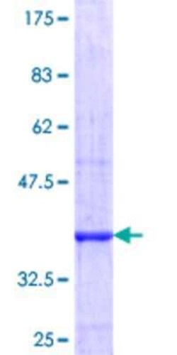 Novus Biologicals Recombinant Human PPP2R5C GST (N-Term) Protein 25 &mu;g | Buy Online | Novus Biologicals&trade; | Fisher Scientific