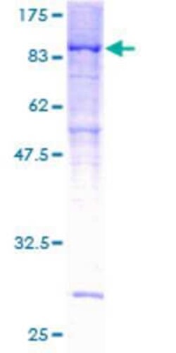 Novus Biologicals Recombinant Human PPP2R5D GST (N-Term) Protein 25 &mu;g | Buy Online | Novus Biologicals&trade; | Fisher Scientific