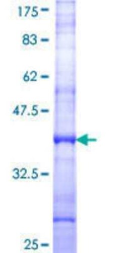 Novus Biologicals Recombinant Human PPP2R5E GST (N-Term) Protein 10 &mu;g | Buy Online | Novus Biologicals&trade; | Fisher Scientific
