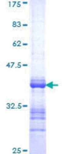 Novus Biologicals Recombinant Human PPP3CB GST (N-Term) Protein 10 &mu;g | Buy Online | Novus Biologicals&trade; | Fisher Scientific
