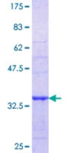 Novus Biologicals Recombinant Human PPP3CC GST (N-Term) Protein 25 &mu;g | Buy Online | Novus Biologicals&trade; | Fisher Scientific