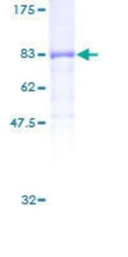Novus Biologicals Recombinant Human PP5 GST (N-Term) Protein 25 &mu;g | Buy Online | Novus Biologicals&trade; | Fisher Scientific