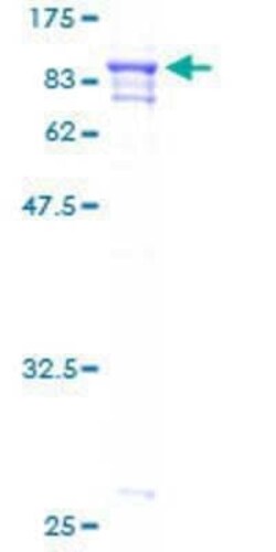 Novus Biologicals Recombinant Human PRCC GST (N-Term) Protein 2 &mu;g | Buy Online | Novus Biologicals&trade; | Fisher Scientific