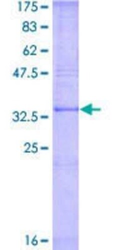 Novus Biologicals Recombinant Human MBP-1 GST (N-Term) Protein 2 &mu;g | Buy Online | Novus Biologicals&trade; | Fisher Scientific