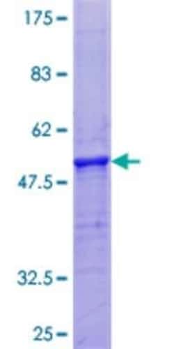 Novus Biologicals Recombinant Human PRH2 GST (N-Term) Protein 25 &mu;g | Buy Online | Novus Biologicals&trade; | Fisher Scientific