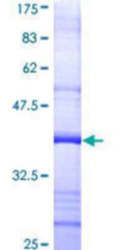 Novus Biologicals Recombinant Human DNA Primase small subunit GST (N-Term) Protein 25 &mu;g | Buy Online | Novus Biologicals&trade; | Fisher Scientific