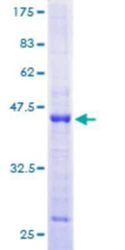 Novus Biologicals Recombinant Human DNA Primase large subunit GST (N-Term) Protein 25 &mu;g | Buy Online | Novus Biologicals&trade; | Fisher Scientific