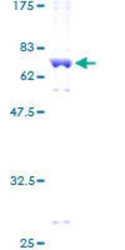 Novus Biologicals Recombinant Human PKA C-gamma GST (N-Term) Protein 10 &mu;g | Buy Online | Novus Biologicals&trade; | Fisher Scientific
