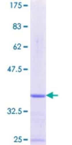 Novus Biologicals Recombinant Human PKI-alpha GST (N-Term) Protein 2 &mu;g | Buy Online | Novus Biologicals&trade; | Fisher Scientific