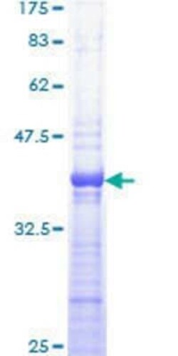 Novus Biologicals Recombinant Human Protein Kinase A regulatory subunit I alpha GST (N-Term) Protein 10 &mu;g | Buy Online | Novus Biologicals&trade; | Fisher Scientific