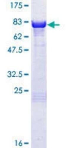 Novus Biologicals Recombinant Human PKA RI beta GST (N-Term) Protein 25 &mu;g | Buy Online | Novus Biologicals&trade; | Fisher Scientific