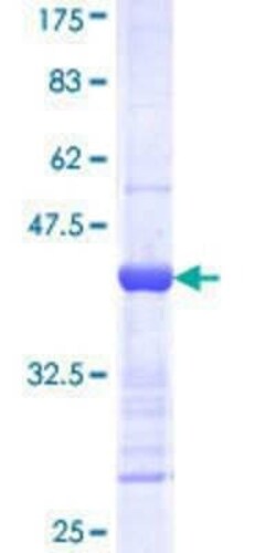 Novus Biologicals Recombinant Human PKA 2 beta GST (N-Term) Protein 10 &mu;g | Buy Online | Novus Biologicals&trade; | Fisher Scientific