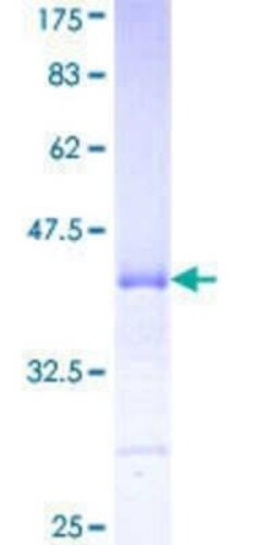 Novus Biologicals Recombinant Human PKC eta GST (N-Term) Protein 2 &mu;g | Buy Online | Novus Biologicals&trade; | Fisher Scientific