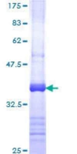 Novus Biologicals Recombinant Human PKC theta GST (N-Term) Protein 25 &mu;g | Buy Online | Novus Biologicals&trade; | Fisher Scientific