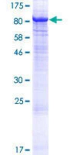 Novus Biologicals™ Recombinant Human PKC zeta GST (N-Term) Protein