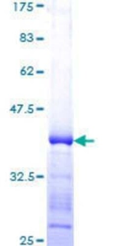 Novus Biologicals Recombinant Human DNA-PKcs GST (N-Term) Protein 10 &mu;g | Buy Online | Novus Biologicals&trade; | Fisher Scientific