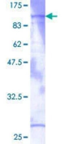 Novus Biologicals Recombinant Human cGK1/PRKG1 GST (N-Term) Protein 10 &mu;g | Buy Online | Novus Biologicals&trade; | Fisher Scientific