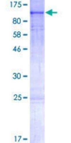 Novus Biologicals Recombinant Human cGK2/PRKG2 GST (N-Term) Protein 2 &mu;g | Buy Online | Novus Biologicals&trade; | Fisher Scientific