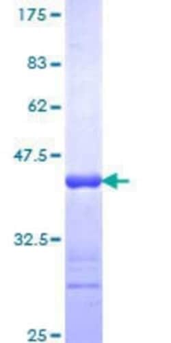 Novus Biologicals Recombinant Human cGK2/PRKG2 GST (N-Term) Protein 10 &mu;g | Buy Online | Novus Biologicals&trade; | Fisher Scientific