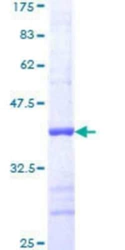 Novus Biologicals Recombinant Human MEK1 GST (N-Term) Protein 25 &mu;g | Buy Online | Novus Biologicals&trade; | Fisher Scientific