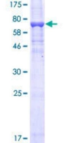 Novus Biologicals Recombinant Human MEK5 GST (N-Term) Protein 10 &mu;g | Buy Online | Novus Biologicals&trade; | Fisher Scientific
