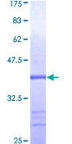 Novus Biologicals Recombinant Human MEK5 GST (N-Term) Protein 10 &mu;g | Buy Online | Novus Biologicals&trade; | Fisher Scientific
