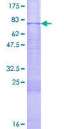 Novus Biologicals Recombinant Human MKK7/MEK7 GST (N-Term) Protein 2 &mu;g | Buy Online | Novus Biologicals&trade; | Fisher Scientific