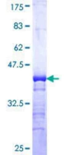 Novus Biologicals Recombinant Human MKK7/MEK7 GST (N-Term) Protein 25 &mu;g | Buy Online | Novus Biologicals&trade; | Fisher Scientific