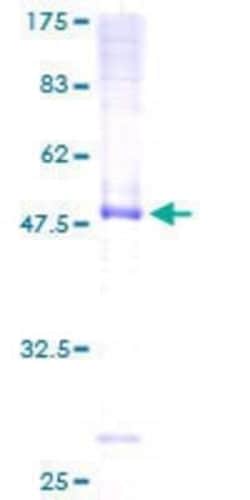 Novus Biologicals Recombinant Human DNAJC3 GST (N-Term) Protein 25 &mu;g | Buy Online | Novus Biologicals&trade; | Fisher Scientific