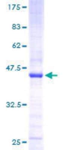 Novus Biologicals Recombinant Human PRKRIR GST (N-Term) Protein 25 &mu;g | Buy Online | Novus Biologicals&trade; | Fisher Scientific