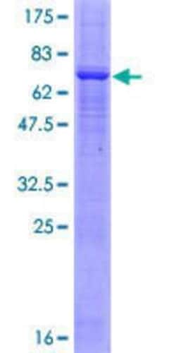 Novus Biologicals Recombinant Human PRKX GST (N-Term) Protein 10 &mu;g | Buy Online | Novus Biologicals&trade; | Fisher Scientific