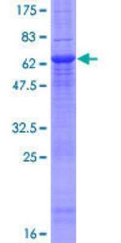 Novus Biologicals Recombinant Human Protein kinase Y linked GST (N-Term) Protein 25 &mu;g | Buy Online | Novus Biologicals&trade; | Fisher Scientific