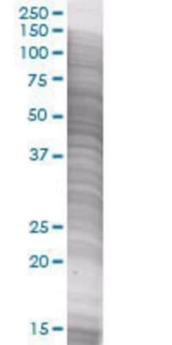 Novus Biologicals™ Coagulation Factor XIV/Protein C 293T Cell Transient Overexpression Lysate