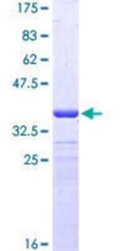 Novus Biologicals Recombinant Human PRODH GST (N-Term) Protein 10 &mu;g | Buy Online | Novus Biologicals&trade; | Fisher Scientific