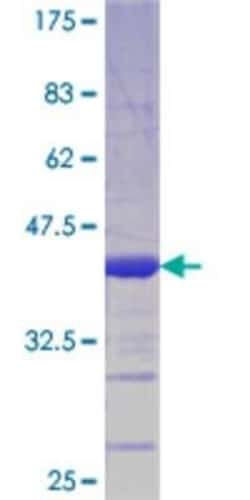 Novus Biologicals Recombinant Human Prox1 GST (N-Term) Protein 10 &mu;g | Buy Online | Novus Biologicals&trade; | Fisher Scientific