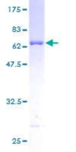Novus Biologicals&trade;&nbsp;Recombinant Human PAP39 GST (N-Term) Protein