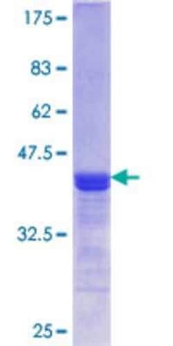 Novus Biologicals Recombinant Human PAP39 GST (N-Term) Protein 25 &mu;g | Buy Online | Novus Biologicals&trade; | Fisher Scientific