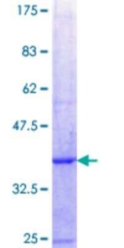 Novus Biologicals Recombinant Human PAP39 GST (N-Term) Protein 25 &mu;g | Buy Online | Novus Biologicals&trade; | Fisher Scientific