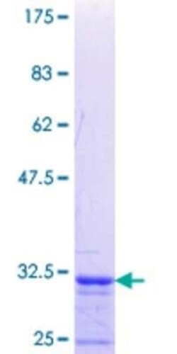 Novus Biologicals Recombinant Human PRRG1 GST (N-Term) Protein 10 &mu;g | Buy Online | Novus Biologicals&trade; | Fisher Scientific