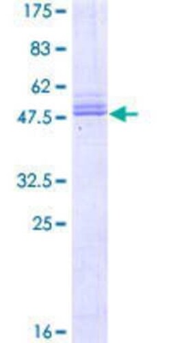 Novus Biologicals Recombinant Human PRRG2 GST (N-Term) Protein 25 &mu;g | Buy Online | Novus Biologicals&trade; | Fisher Scientific