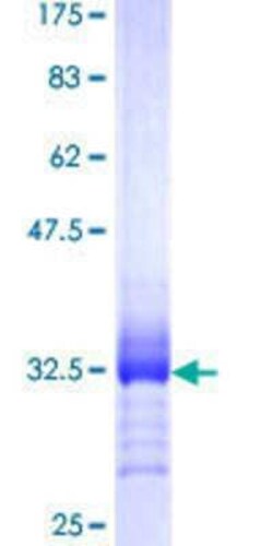 Novus Biologicals Recombinant Human PRRG2 GST (N-Term) Protein 10 &mu;g | Buy Online | Novus Biologicals&trade; | Fisher Scientific