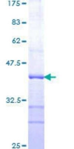 Novus Biologicals Recombinant Human Presenilin-1 GST (N-Term) Protein 25 &mu;g | Buy Online | Novus Biologicals&trade; | Fisher Scientific