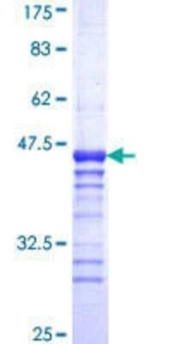Novus Biologicals Recombinant Human Presenilin-2 GST (N-Term) Protein 25 &mu;g | Buy Online | Novus Biologicals&trade; | Fisher Scientific