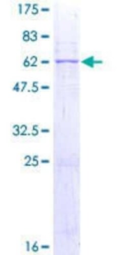 Novus Biologicals Recombinant Human PSG2 GST (N-Term) Protein 10 &mu;g | Buy Online | Novus Biologicals&trade; | Fisher Scientific