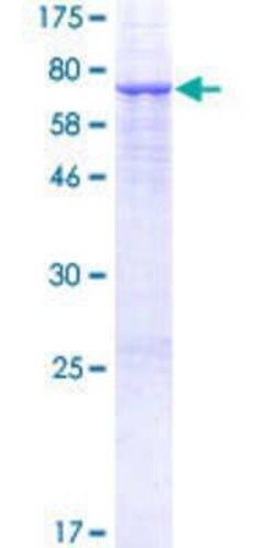 Novus Biologicals Recombinant Human PSG3 GST (N-Term) Protein 25 &mu;g | Buy Online | Novus Biologicals&trade; | Fisher Scientific