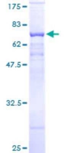 Novus Biologicals Recombinant Human PSG9 GST (N-Term) Protein 25 &mu;g | Buy Online | Novus Biologicals&trade; | Fisher Scientific